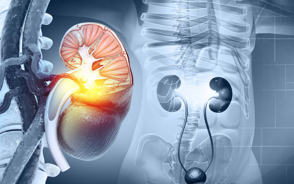 diete-speciale-calculs-renaux