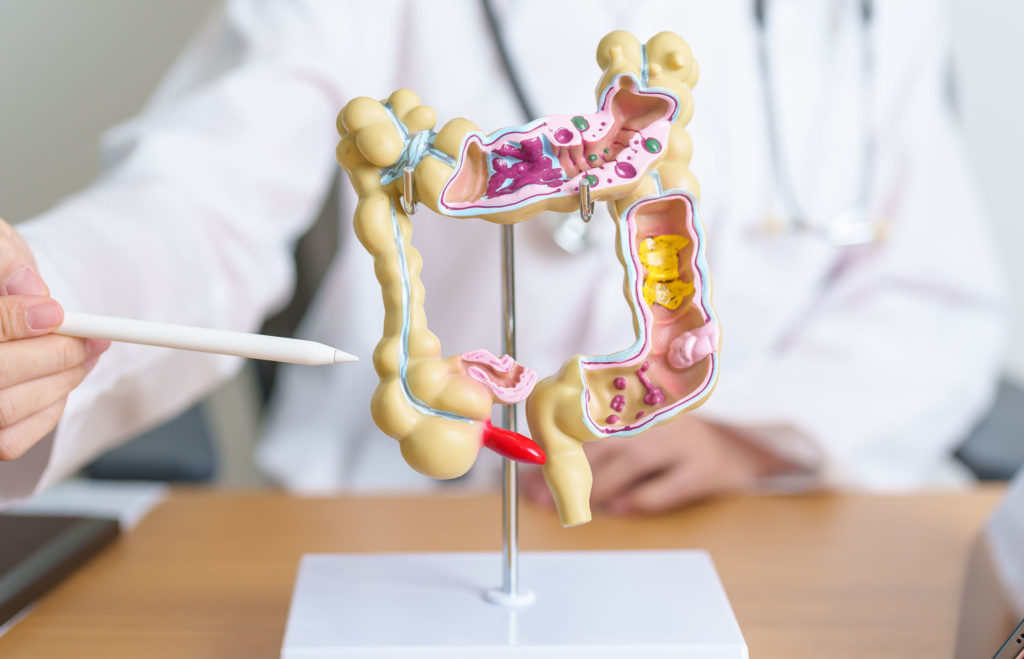 diete-speciale-diverticulose-diverticulite