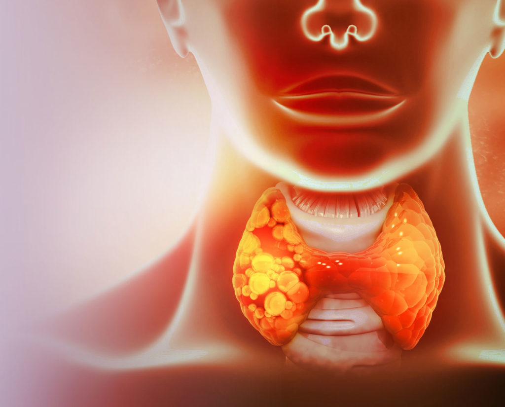 diete-speciale-hypothyroidie