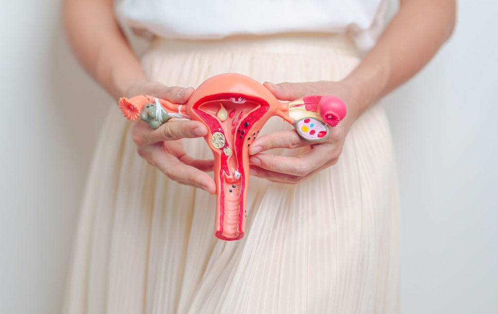 diete-speciale-ovaires-polykystiques